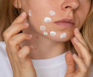 How To Choose The Right Hyperpigmentation Treatment: What You Need To Know