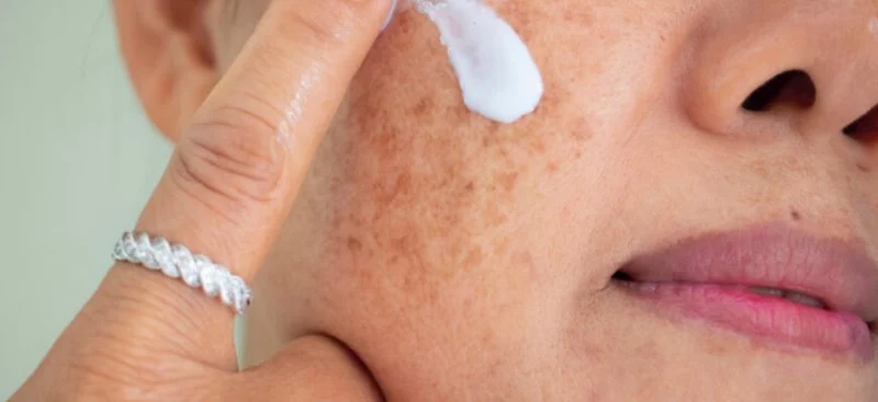 How to Prevent and Treat Age Spots with Proper Skin Care