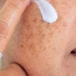 How to Prevent and Treat Age Spots with Proper Skin Care