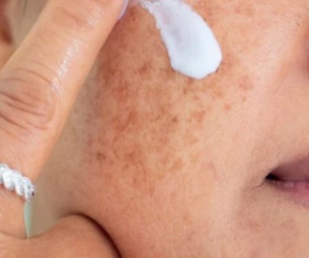 How to Prevent and Treat Age Spots with Proper Skin Care