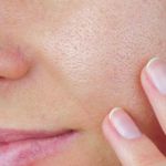 How To Choose The Right Natural Remedies for Large Pores