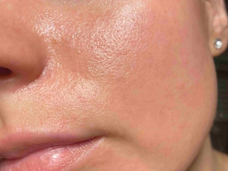 Skin Care Tips For Facial Oils To Improve Large Pores
