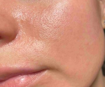 Skin Care Tips For Facial Oils To Improve Large Pores