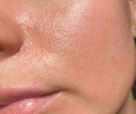 Skin Care Tips For Facial Oils To Improve Large Pores