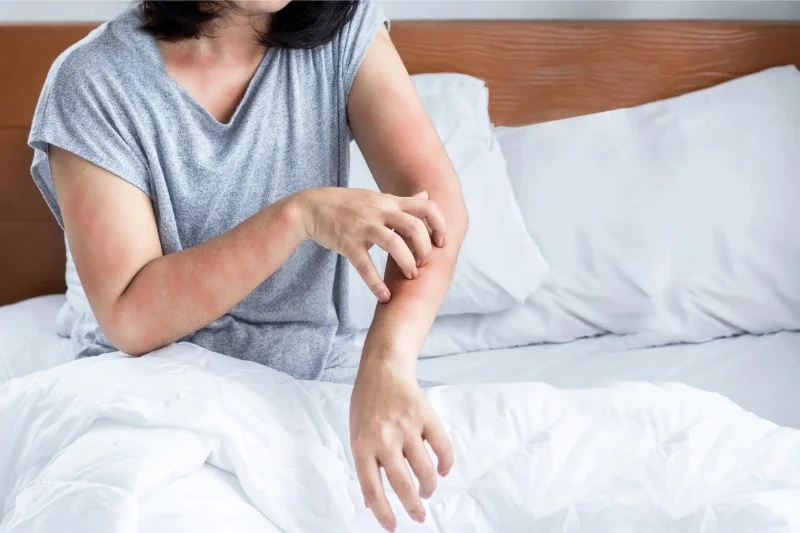 How to Treat and Prevent Skin Rashes with Gentle Skin Care Products
