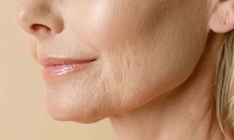 How to Treat and Prevent Fine Lines Around Your Eyes and Mouth