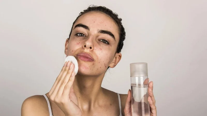 How to Create the Best Skin Care Routine for Acne-Prone Skin