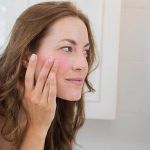 How to Take Care of Your Skin When You Have Sensitive Skin