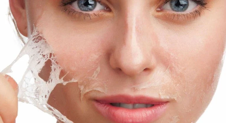 How to Treat Skin Peels and Flakes with Moisturizers