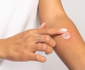 How to Treat and Prevent Skin Infections