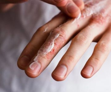 The Best Skincare Routine for Healing Dry, Cracked Skin: Expert Tips and Solutions