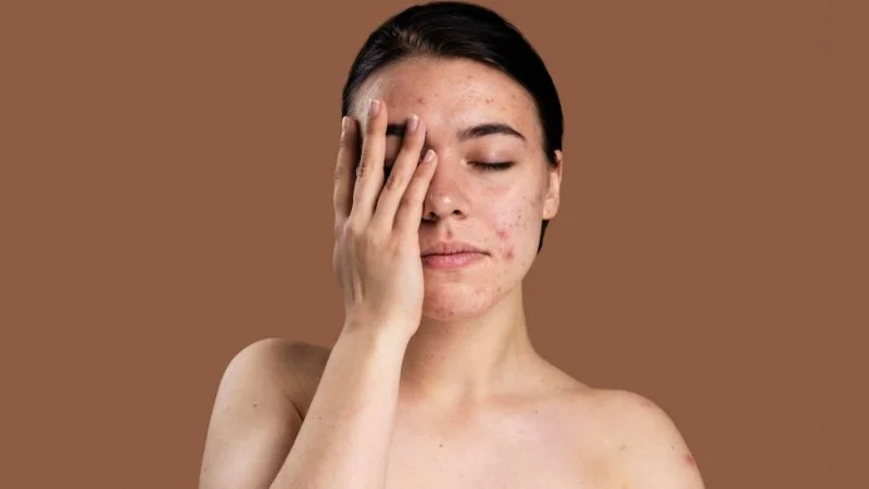 How to Repair Skin Damage from Pollution with Skin Care Products