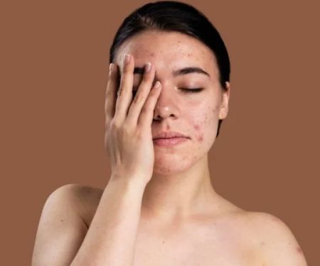 How to Repair Skin Damage from Pollution with Skin Care Products