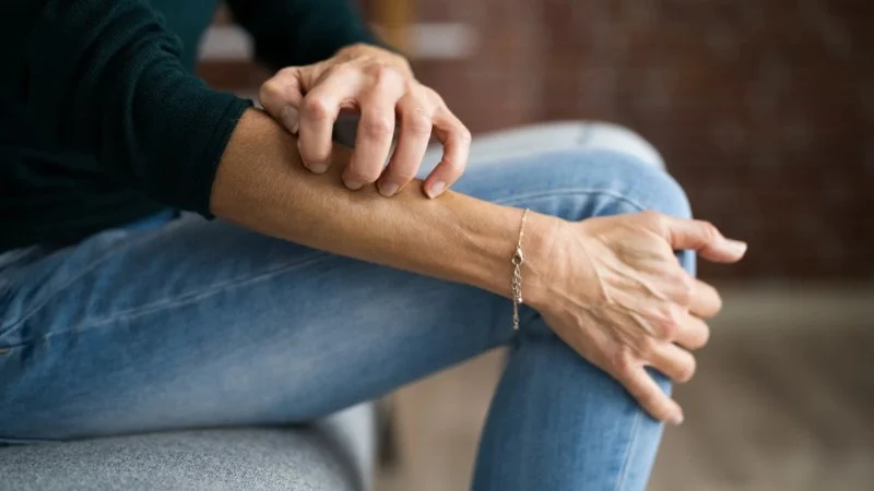 How to Treat Skin Flare-Ups from Stress with the Right Products