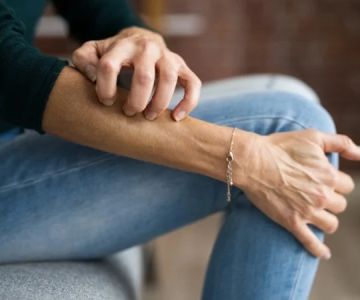 How to Treat Skin Flare-Ups from Stress with the Right Products