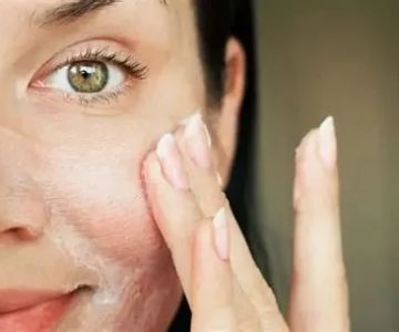 Best Skin Care Routine for Combination Skin: Expert Advice