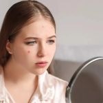 How to Prevent Skin Breakouts During Your Menstrual Cycle