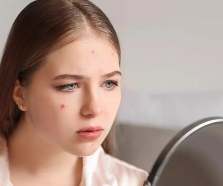 How to Prevent Skin Breakouts During Your Menstrual Cycle