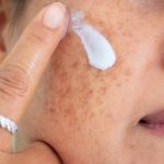 How to Treat Skin Discoloration with Targeted Skin Care Products