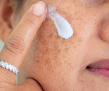 How to Treat Skin Discoloration with Targeted Skin Care Products