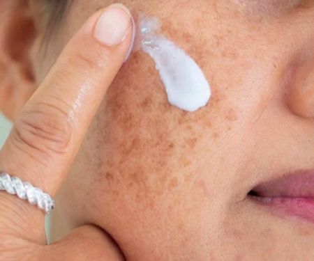 How to Treat Skin Discoloration with Targeted Skin Care Products