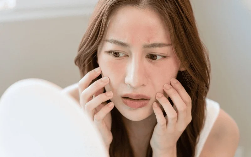 The Best Skin Care Products for Reducing Skin Inflammation: Top Picks