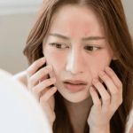 The Best Skin Care Products for Reducing Skin Inflammation: Top Picks