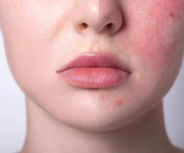 How to Treat Skin Allergies with Gentle Skin Care Solutions