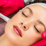 What Is Microneedling and How Can It Improve Your Skin?