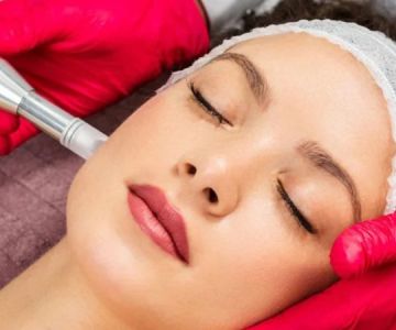 What Is Microneedling and How Can It Improve Your Skin?