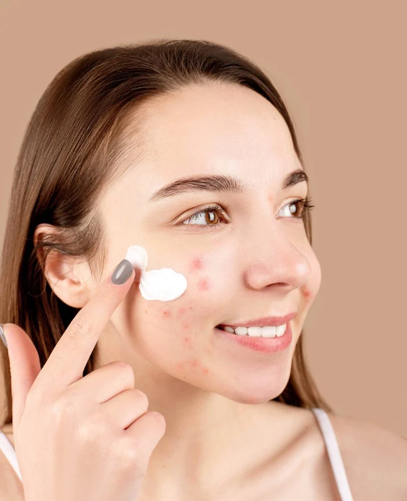 The Best Skincare Products for Sensitive and Acne-Prone Skin