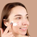 The Best Skincare Products for Sensitive and Acne-Prone Skin