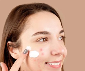 The Best Skincare Products for Sensitive and Acne-Prone Skin
