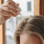 How to Treat Dry Scalp and Skin with Simple Natural Remedies