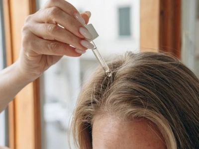 How to Treat Dry Scalp and Skin with Simple Natural Remedies