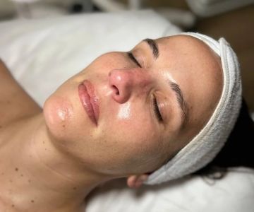 Effective Methods on How to Treat Dehydrated Skin and Restore Moisture