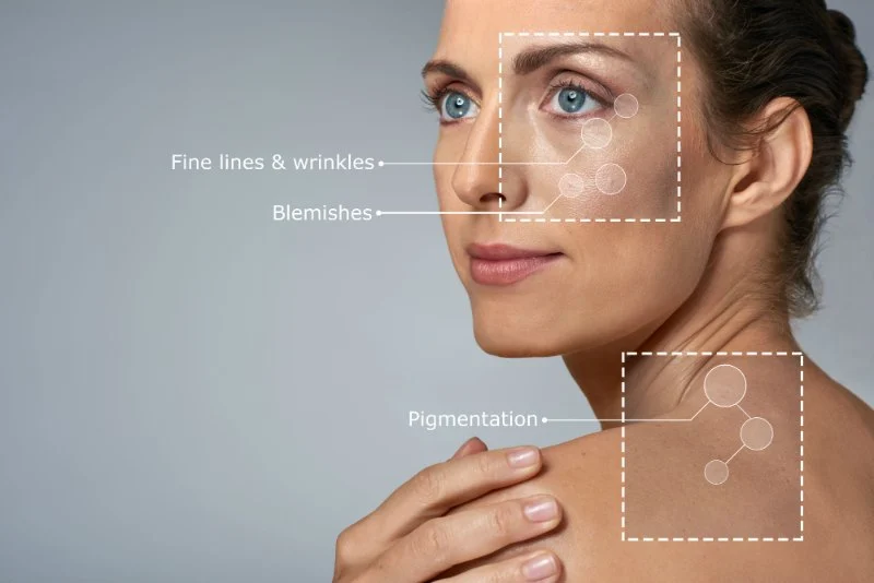 Top Products to Treat and Prevent Skin Aging | SkinCare Experts
