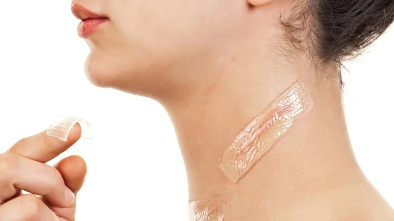 How to Heal and Prevent Skin Scarring with Proper Skin Care Treatments