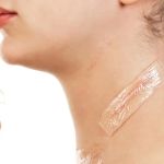 How to Heal and Prevent Skin Scarring with Proper Skin Care Treatments