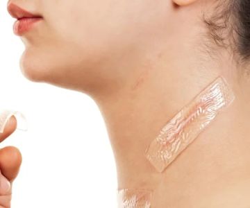 How to Heal and Prevent Skin Scarring with Proper Skin Care Treatments
