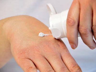 Effective Ways to Prevent Skin Dryness During Winter with Hydrating Creams