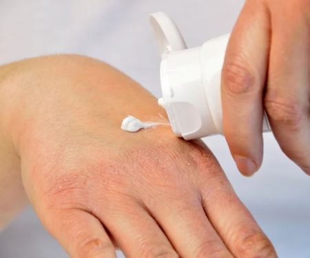 Effective Ways to Prevent Skin Dryness During Winter with Hydrating Creams