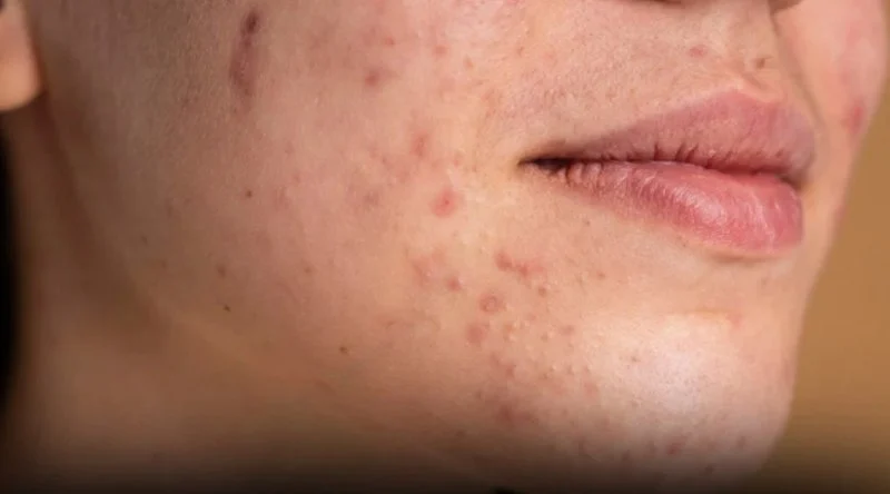 How to Protect Skin from Pollution and Environmental Damage Effectively