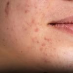 How to Protect Skin from Pollution and Environmental Damage Effectively