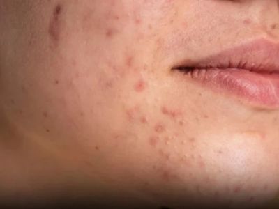 How to Protect Skin from Pollution and Environmental Damage Effectively