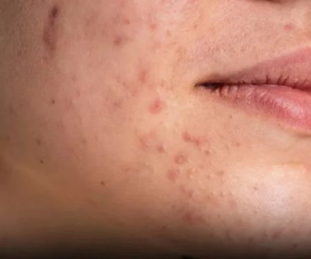 How to Protect Skin from Pollution and Environmental Damage Effectively