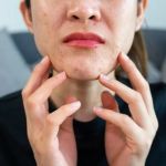 How to Prevent and Treat Sensitive Skin Breakouts Effectively