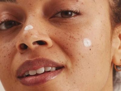 The Best Products for Treating and Preventing Skin Damage from the Sun