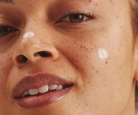 The Best Products for Treating and Preventing Skin Damage from the Sun