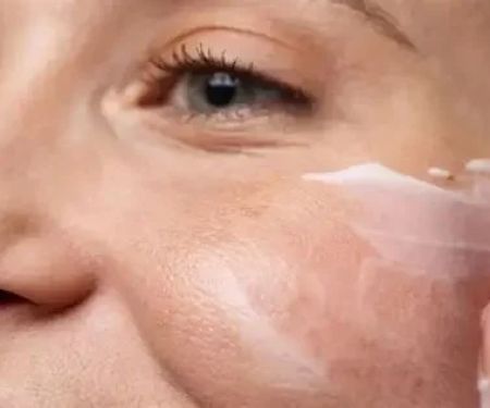 How to Treat Skin Dehydration and Restore Moisture with Top Products